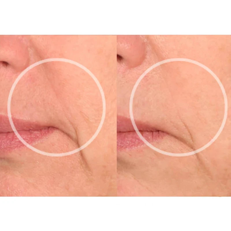 Plaquinha Rejuderme® - Sorriso